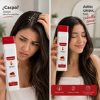 Tratamiento Vinagre Capilar Frutos Rojos Adara Control de Caspa Cuidado Capilar